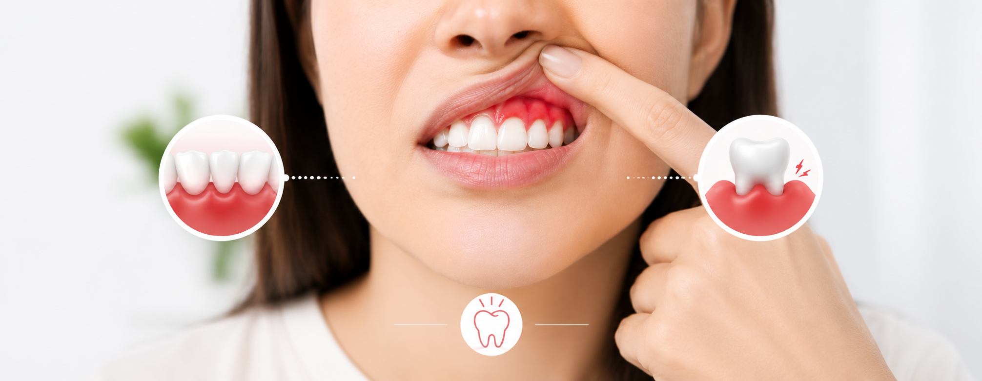 Close-up of a woman gently pulling back her upper lip to reveal swollen, red gums, alongside the title “How to Get Rid of Swollen Gums” on a clean white background.